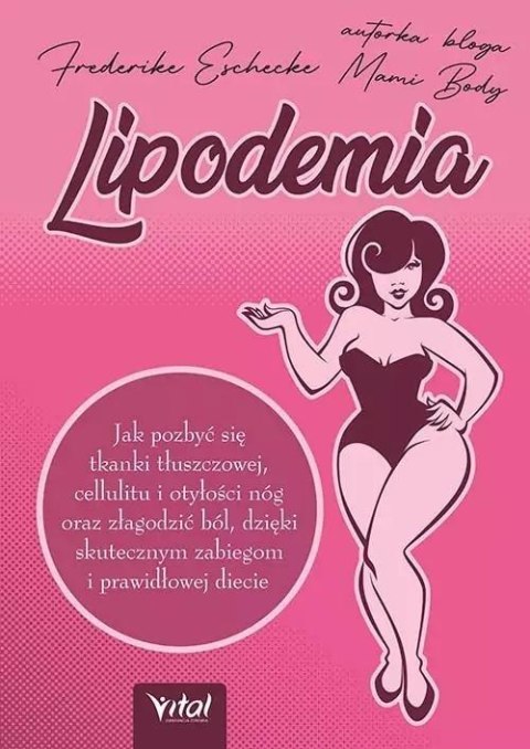 Lipodemia