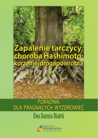 Zapalenie tarczycy, choroba Hashimoto